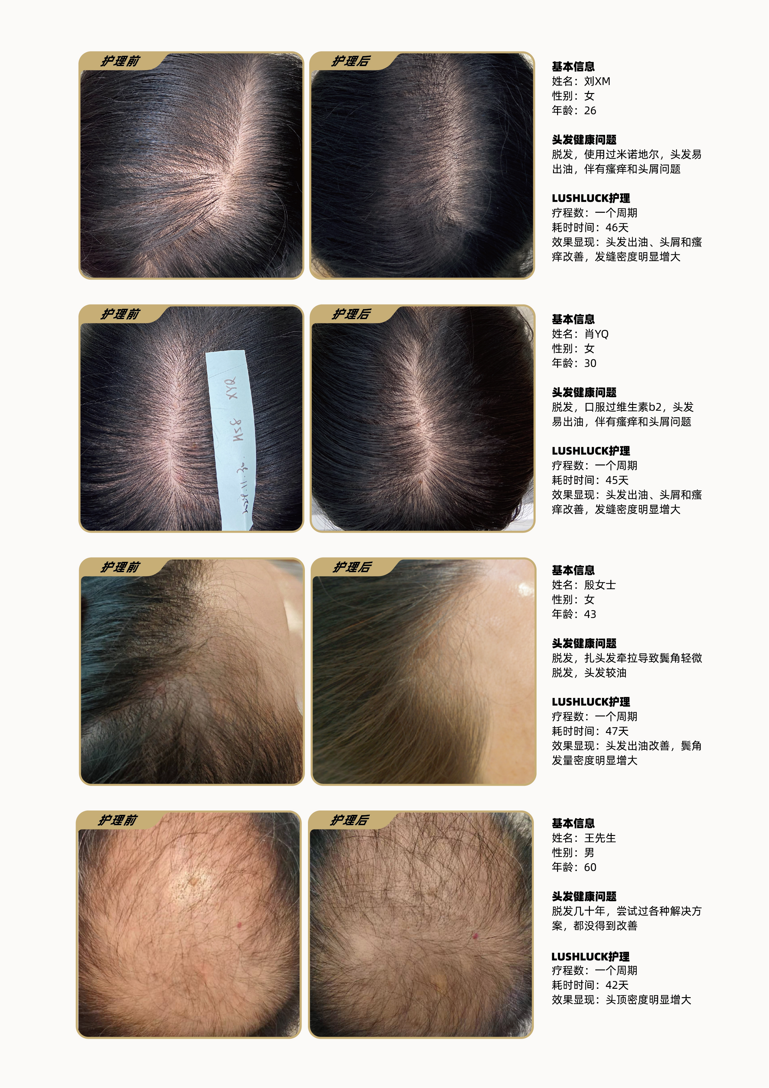 毛囊源力炮产品介绍手册_14