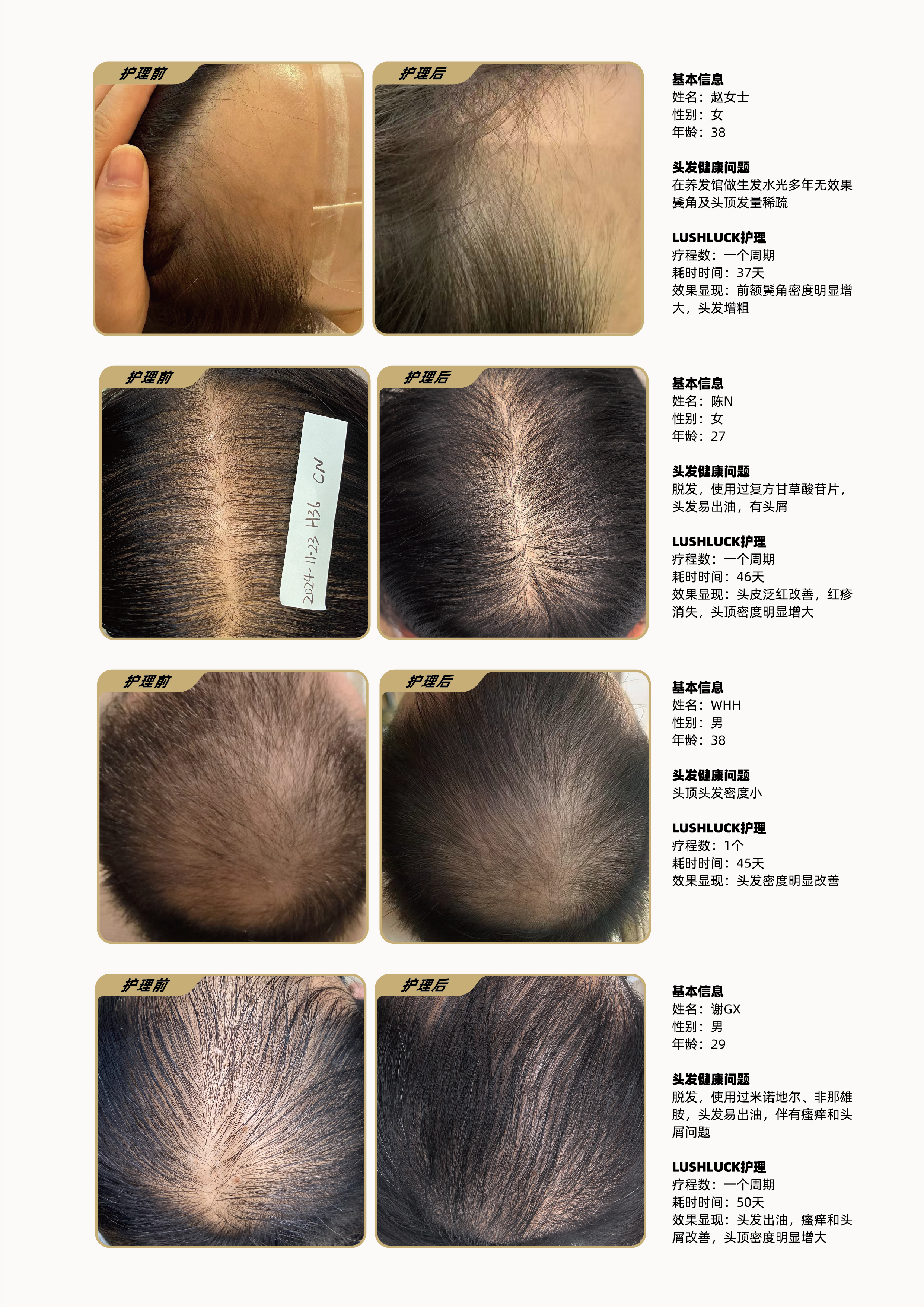毛囊源力炮产品介绍手册_15